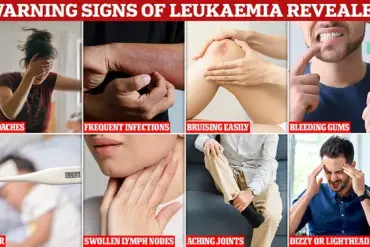 Persistent Gum Bleeding Led to Discovery of Rare Cancer in Edinburgh Student